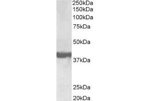 Image no. 1 for anti-Endophilin-A1 (SH3G2) (Internal Region) antibody (Biotin) (ABIN5539854)
