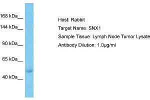 Image no. 2 for anti-Sorting Nexin 1 (SNX1) (C-Term) antibody (ABIN5515146)