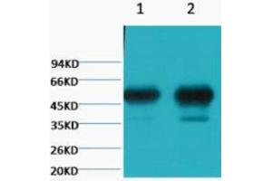 Image no. 1 for anti-Tubulin, beta 2A (TUBB2A) antibody (ABIN3181221)