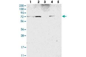 Image no. 2 for anti-Zinc Finger Protein 846 (ZNF846) antibody (ABIN5591469)