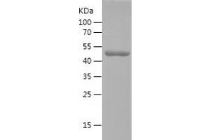 SART3 Protein (AA 19-207) (His-IF2DI Tag)