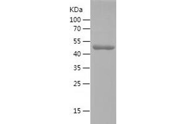 SART3 Protein (AA 19-207) (His-IF2DI Tag)