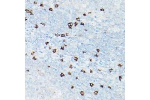 Immunohistochemistry of paraffin-embedded human tonsil using CD8A Rabbit mAb (ABIN1512846, ABIN3021030, ABIN3021031 and ABIN7101333) at dilution of 1:100 (40x lens).