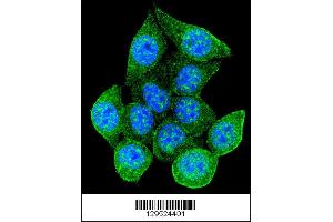 Image no. 1 for anti-RAD9 Homolog A (S. Pombe) (RAD9A) (Ser387) antibody (ABIN2496171)