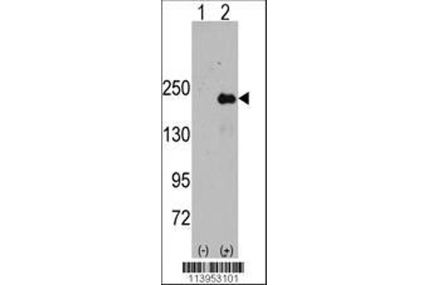 anti-Sperm Associated Antigen 9 (SPAG9) (AA 603-632) antibody