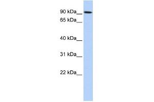Image no. 1 for anti-Transglutaminase 1, Keratinocyte (TGM1) antibody (ABIN632050)