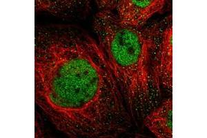 Image no. 1 for anti-Male-Specific Lethal 1 Homolog (MSL1) antibody (ABIN5583829)