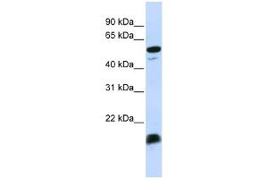 Image no. 2 for anti-Complement Component 4 Binding Protein, alpha (C4BPA) (Middle Region) antibody (ABIN2776798)
