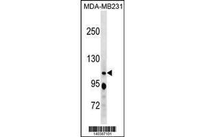 Image no. 1 for anti-Retinoblastoma-Like 1 (p107) (RBL1) (AA 1007-1035), (C-Term) antibody (ABIN1881732)