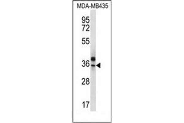 OR51Q1 Antikörper  (N-Term)