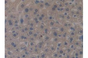 Detection of MUC1 in Mouse Liver Tissue using Polyclonal Antibody to Mucin 1 (MUC1)