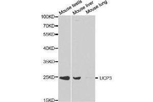 Image no. 2 for anti-Uncoupling Protein 3 (Mitochondrial, Proton Carrier) (UCP3) antibody (ABIN3022086)
