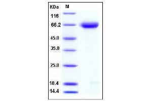Image no. 1 for Reticulon 4 Receptor (RTN4R) (AA 1-447), (Mature) (Active) protein (His tag) (ABIN2007332)