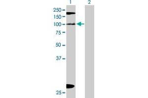 Image no. 1 for anti-Cell Cycle and Apoptosis Regulator 2 (CCAR2) (AA 1-923) antibody (ABIN528320)