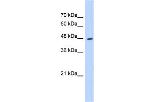 Image no. 3 for anti-Hydroxyacyl-CoA Dehydrogenase/3-Ketoacyl-CoA Thiolase/enoyl-CoA Hydratase (Trifunctional Protein), beta Subunit (HADHB) (C-Term) antibody (ABIN2783232)
