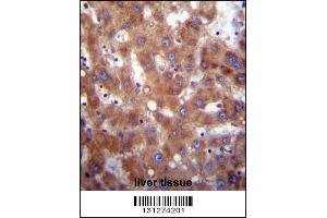 Image no. 2 for anti-Hydroxysteroid (17-Beta) Dehydrogenase 4 (HSD17B4) (AA 341-370) antibody (ABIN656447)