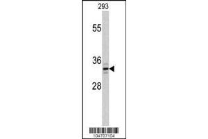 Image no. 1 for anti-Palmitoyl-Protein Thioesterase 1 (PPT1) (AA 269-300), (C-Term) antibody (ABIN389117)