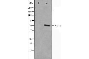 Image no. 1 for anti-POU domain, class 2, transcription factor 2 (POU2F2) antibody (ABIN6263800)