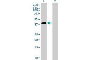 Image no. 1 for anti-Homeobox D13 (HOXD13) (AA 1-343) antibody (ABIN516671)