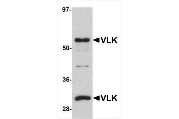 anti-Protein Kinase Domain Containing, Cytoplasmic Homolog (Mouse) (PKDCC) (Center) antibody