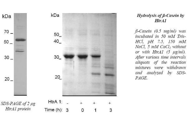 HtrA Serine Peptidase 1 (HTRA1) protein (His tag)