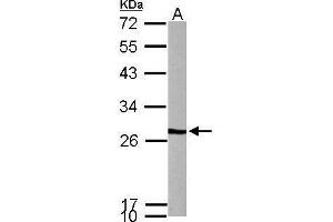 Image no. 1 for anti-Prefoldin Subunit 3 (PFDN3) (Center) antibody (ABIN2856974)