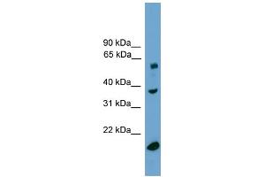 Image no. 2 for anti-Transducin (Beta)-Like 1, Y-Linked (TBL1Y) (Middle Region) antibody (ABIN2784572)
