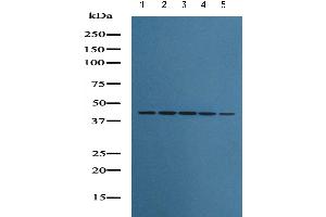 Image no. 1 for anti-Actin, beta (ACTB) antibody (ABIN6269451)