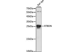 Retbindin anticorps  (AA 63-261)