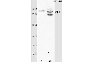 Image no. 2 for anti-Signal Transducer and Activator of Transcription 6, Interleukin-4 Induced (STAT6) (pTyr641) antibody (ABIN734483)