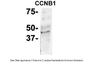 Image no. 1 for anti-Cyclin B1 (CCNB1) (C-Term) antibody (ABIN2779290)