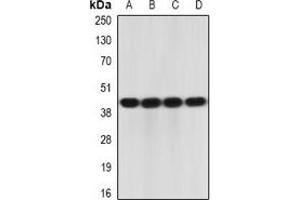 Image no. 3 for anti-Interleukin 23 Receptor (IL23R) antibody (ABIN3197697)
