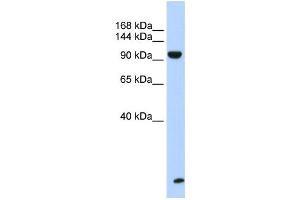 Image no. 1 for anti-Trinucleotide Repeat Containing 6B (TNRC6B) antibody (ABIN2458485)