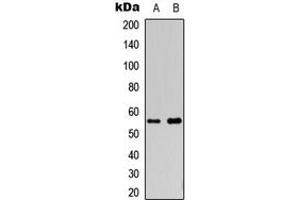 Image no. 3 for anti-Cytochrome P450, Family 2, Subfamily S, Polypeptide 1 (CYP2S1) (Center) antibody (ABIN2705992)