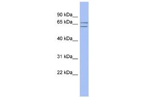 Image no. 1 for anti-SLU7 Splicing Factor Homolog (SLU7) (N-Term) antibody (ABIN2784811)