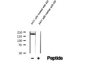 Image no. 2 for anti-Afadin (MLLT4) (pSer1799) antibody (ABIN6255032)