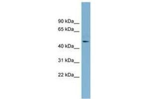 Image no. 1 for anti-Trimethyllysine Hydroxylase, epsilon (TMLHE) (AA 323-372) antibody (ABIN6742153)