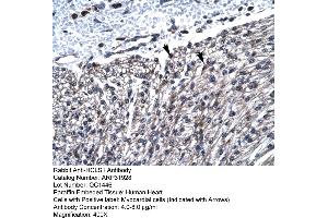 Image no. 6 for anti-Hematopoietic Cell-Specific Lyn Substrate 1 (HCLS1) (N-Term) antibody (ABIN2777503)