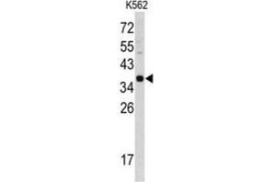 Image no. 2 for anti-Cathepsin E (CTSE) antibody (ABIN3002688)