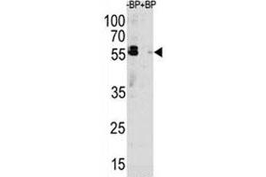 Image no. 7 for anti-Sequestosome 1 (SQSTM1) (AA 317-346) antibody (ABIN3031543)
