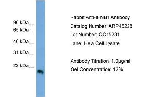 Image no. 1 for anti-Interferon, beta 1, Fibroblast (IFNB1) (Middle Region) antibody (ABIN2782159)