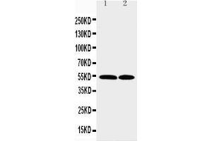 Image no. 1 for anti-Chemokine (C-C Motif) Receptor 3 (CCR3) (AA 1-20), (N-Term) antibody (ABIN3043996)
