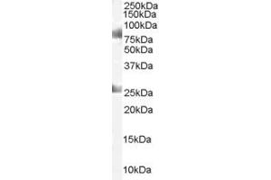 Image no. 1 for anti-Chromodomain Protein, Y-Like (CDYL) (C-Term) antibody (ABIN184904)