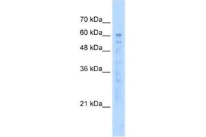 Image no. 1 for anti-EF-hand calcium binding domain 14 (EFCAB14) antibody (ABIN2463041)