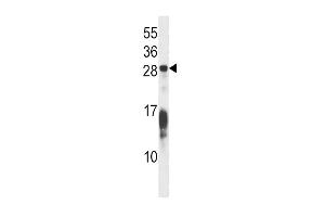 Image no. 1 for anti-RAP1B, Member of RAS Oncogene Family (RAP1B) (AA 150-178), (C-Term) antibody (ABIN5537994)
