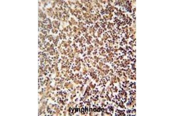 anti-Zinc Finger Protein 98 (ZNF98) (AA 486-516), (C-Term) antibody