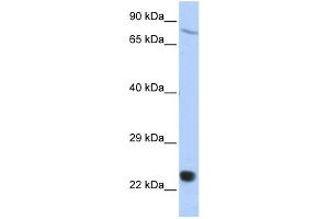 Image no. 1 for anti-SP110 Nuclear Body Protein (SP110) (Middle Region) antibody (ABIN2780261)