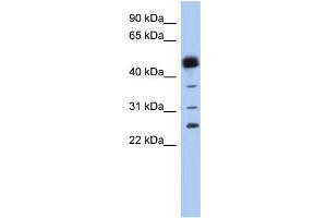PTGDS anticorps  (N-Term)
