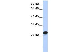 Image no. 2 for anti-Calcyphosine (CAPS) (N-Term) antibody (ABIN2787679)