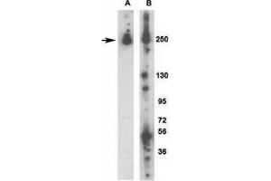 Image no. 4 for anti-Leucine-Rich Repeat Kinase 2 (LRRK2) (AA 931-962) antibody (ABIN3028794)